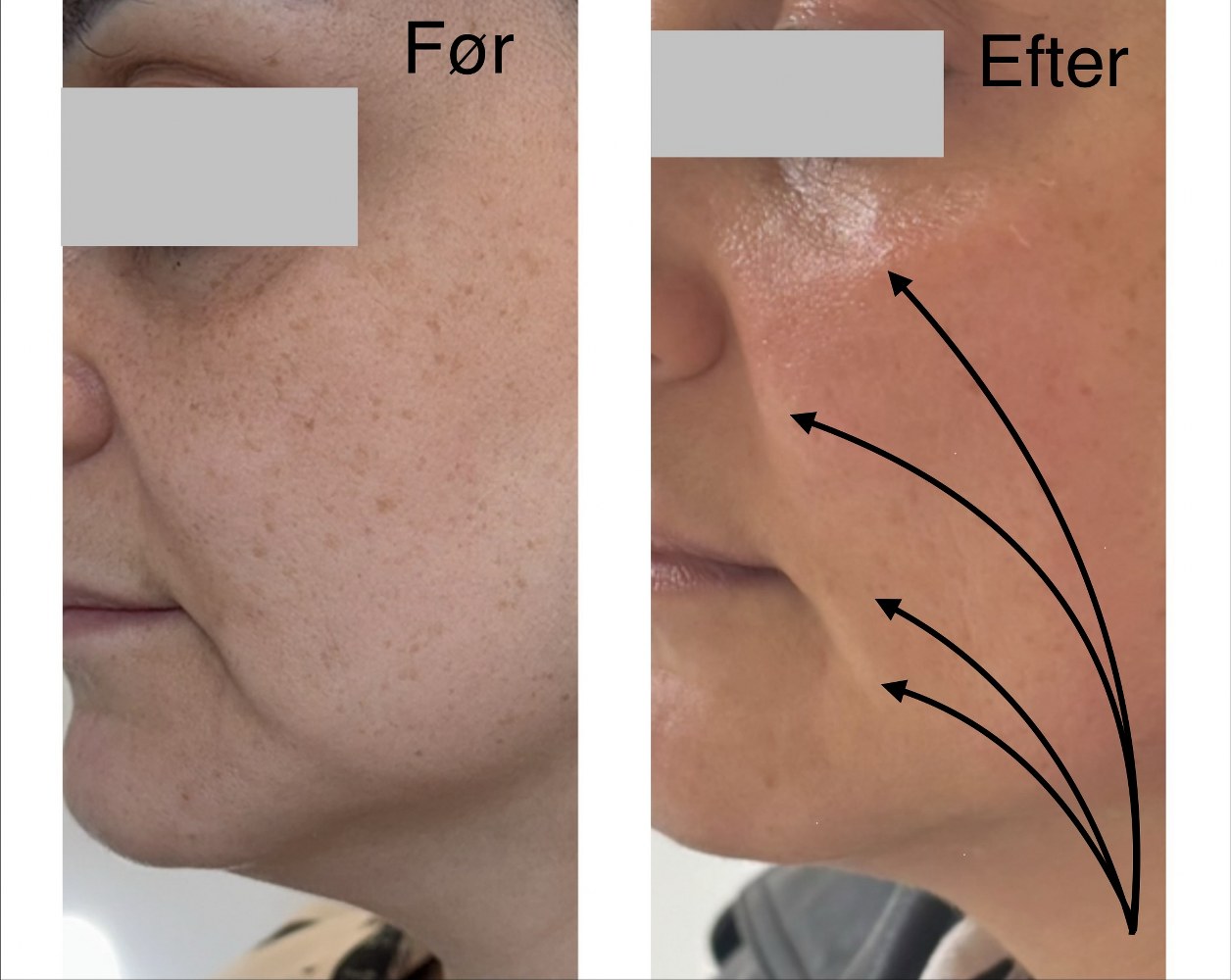 Ems Face Faceefter Elegance Beauty 2 1256X1000